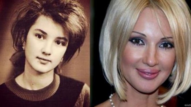 лера кудрявцева в юности и сейчас